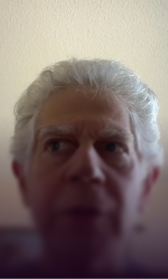 Lotus Health AI story about discovering underlooked fatigue connections